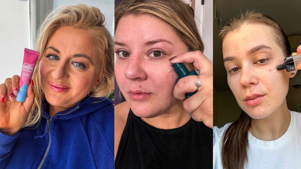 Easy 5 skincare routine for oily & acne-prone skin