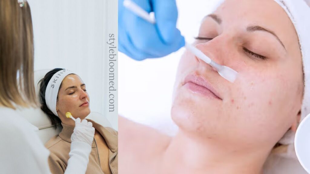 Easy 5 skincare routine for oily & acne-prone skin